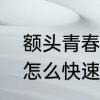 额头青春痘怎么消除　额头上的痘痘怎么快速消除